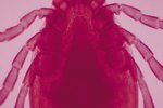 How Long Can a Deer Tick Live After Falling Off a Host?
