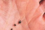 How to Remove Ticks From Ears