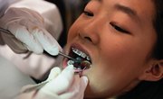 Top Colleges for Orthodontics