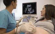 Ultrasound Courses in Ireland
