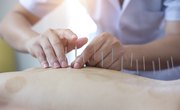 How to Become an Acupuncturist in Canada