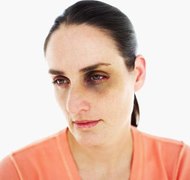 Stockbyte/Stockbyte/Getty Images Domestic violence is one form of marital misconduct.