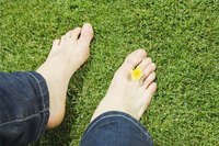 Remove a Bunion