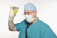 Use Urine to Cure Fungus