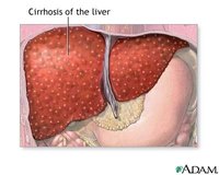 Liver disease prevention