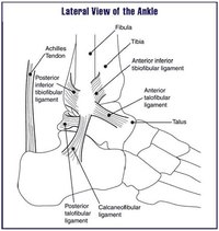 The cross friction massage technique is used to do sports massage for ankle sprains