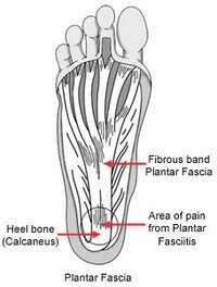 Here's why your foot hurts!