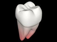 Treating a toothache is not as easy as you may think, it is possible though