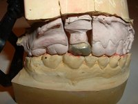 Fake teeth are commonly used in dental schools to demonstrate cleaning techniques.