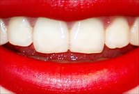 Detect a Cavity