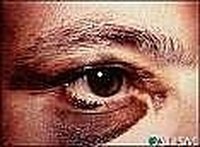 Get Rid of a Black Eye