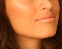 Healthy lips