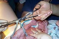 What Is the Umbilical Cord Attached To?