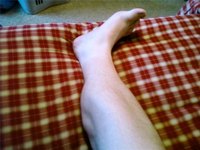 How Does a Leg Cramp Happen?