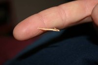 How Does a Splinter Lead to Infection?