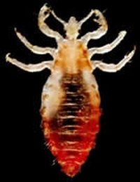 What Do Lice Look Like?
