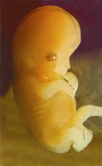 Actual fetus at seven weeks gestational age.