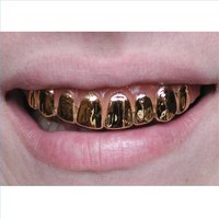 Gold dental crowns are going to be very obvious in the front of your mouth.