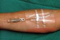 About PICC Lines