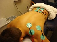 How Does Electrical Muscle Stimulation Work?
