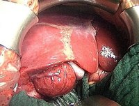 How Does the Liver Work?