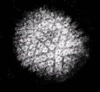 How Can Herpes Be Contracted?