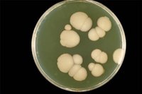 How is Candidiasis Transmitted?