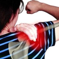 Arthritis Symptoms in the Neck & Shoulders
