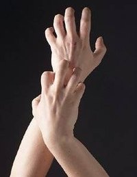 How Does Anti-Itch Cream Work?