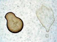 How Does Shout Work to Remove Stains?