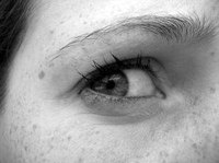 About Mole Removal