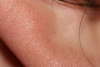 Earlobe