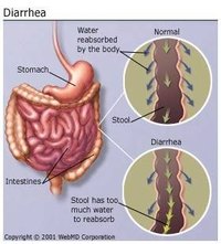 Foods That Cause Diarrhea