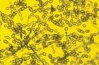 Toxic Mold Symptoms