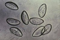 A magnified view of pinworm eggs.