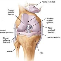 Diagnose Knee Pain
