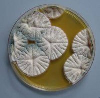 How Does Bleach Kill Mold?
