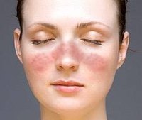 What Are the Causes of Face Rash?