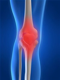 What Are the Treatments for Osteoarthritis in the Knee?