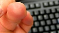 Callused finger