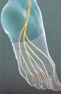 Treatments for Neuropathy of the Feet