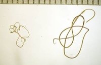 Signs & Symptoms of a Parasitic Worm Infestation