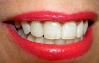 What Do the Letters After a Dentist's Name Mean?