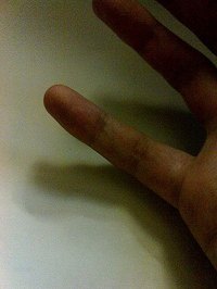 Pinky Finger