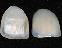 Make Veneers for Teeth