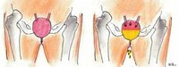 Signs & Symptoms of Urinary Urgency