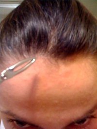 Tweeze Hair on Your Head