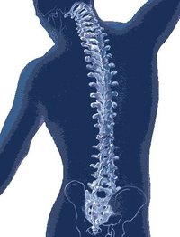What Is Lumbar Radiculitis?