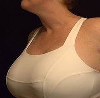 Causes of a Rash Under the Breasts