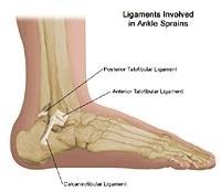 Causes of Sharp Foot Pain